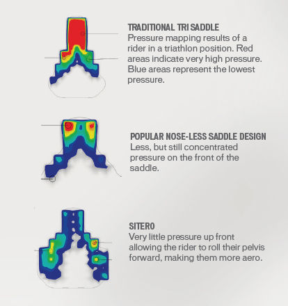 SpecializedSiteroComparason